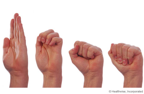 Tendon-glide hand exercises for osteoarthritis Tendon-glide hand exercises for osteoarthritis
